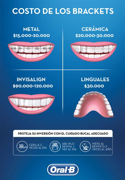 brackets metalicos vs zafiro|cuanto cobran por poner brackets.